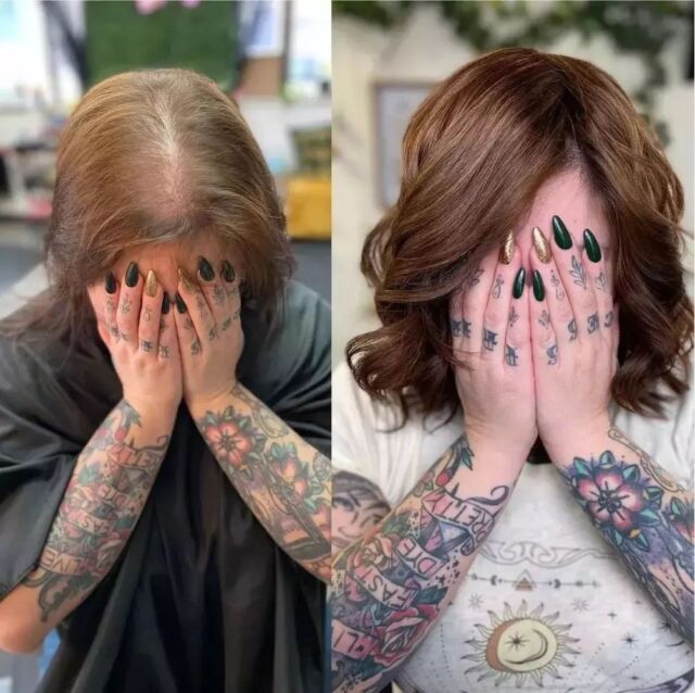 Let's talk: hairloss ✨️ 
#Hairloss can be caused by so many factors:
🎀 Health issues
🎀 Stress
🎀 Hormonal disorders
🎀 Genetics
But that should never stop you from having the hair of your dreams!

Did you know customers in Ireland may be entitled to a €500 grant towards your hair pieces. Contact a Hairwear Certified salon to discuss your options and arrange a free consultation. 

Our 𝗵𝗮𝗶𝗿𝘄𝗲𝗮𝗿® tape-in #hairtopper can last 3-6 weeks (depending on hair growth) before needing to be re-tapped. 
It's 100% human hair so it can be colored, washed, & styled just like your regular hair.

📸 @ladyandthebeardsalon. 

(Clients face is covered for privacy)